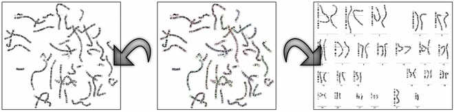 Undo the history of the karyogram image